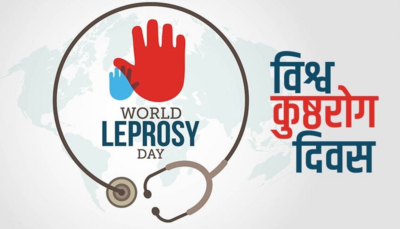 आज विश्व कुष्ठरोग दिवस मनाइदै