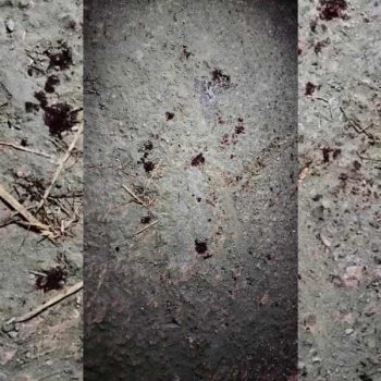 नवलपरासीमा सुनचाँदी व्यवसायीमाथि गोली प्रहार, कस्तो छ अवस्था ?