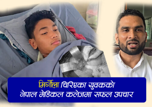 मिर्गौला चिरिएका युवकको नेपाल मेडिकल कलेजले बचायो ज्यान