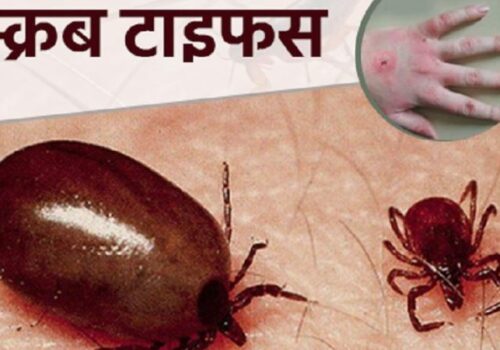 चितवनका  विभिन्न अस्पतालमा ३८६ जनामा स्क्रब टाइफस सङ्क्रमण