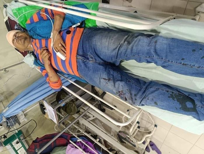 पुण्य गौतममाथी रड प्रहार, आइसियुमा उपचार हुँदै