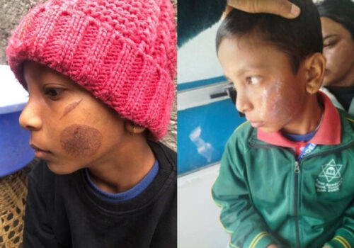 विद्यार्थीले ‘काली’ भनेको आक्रोशमा चार विद्यार्थीको गालामा तातो पन्यूले डाम्ने शिक्षिका पक्राउ