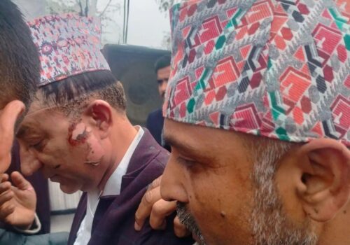 अर्थमन्त्री पौडेल र मेयर आचार्यको अवस्था खतरामुक्त