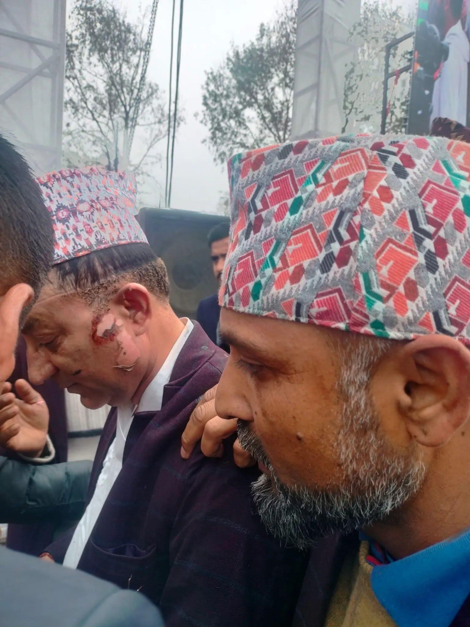 अर्थमन्त्री पौडेल र मेयर आचार्यको अवस्था खतरामुक्त